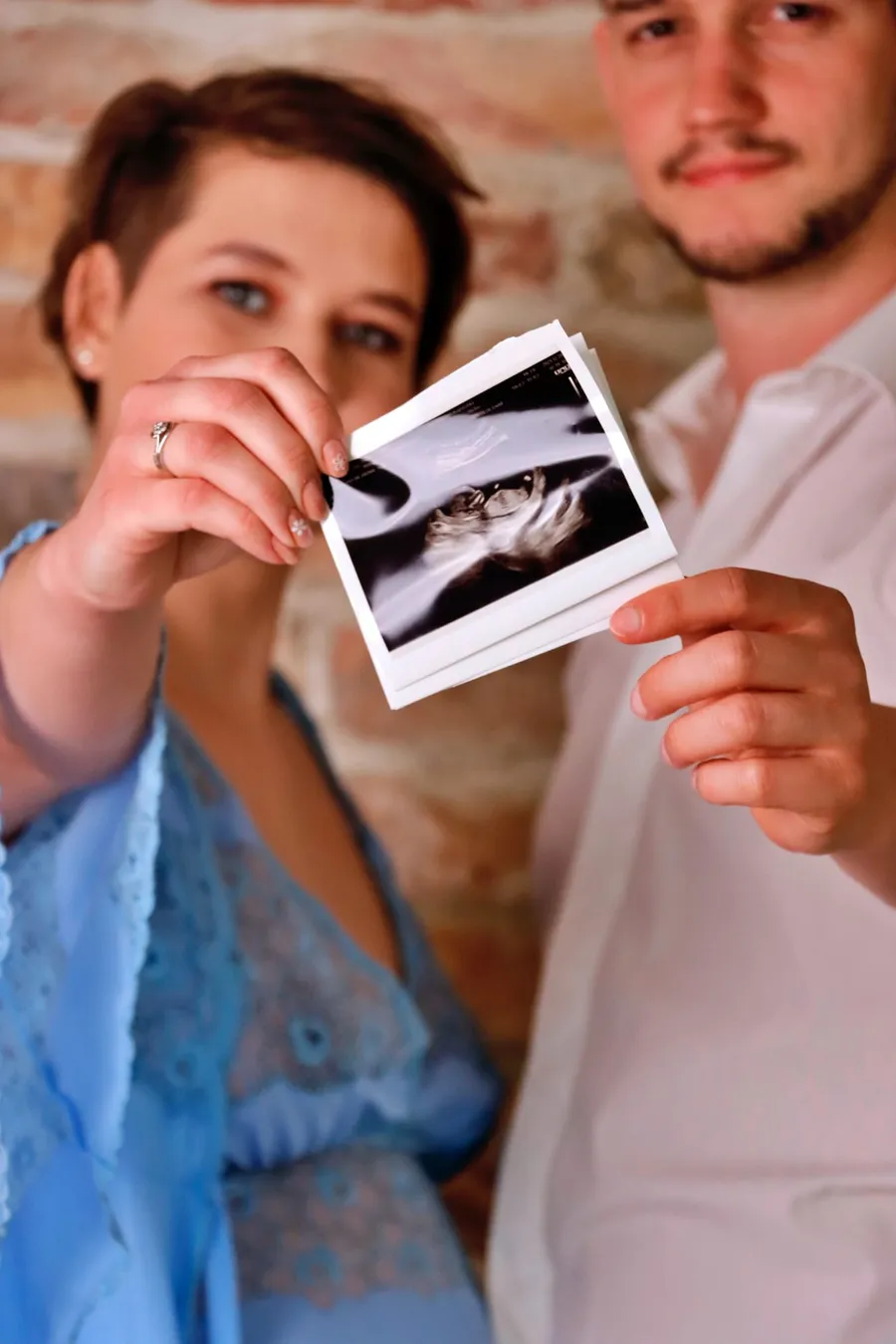 Pár 3D ultrahangképet tart a kezében terhes fotózáson a szabadban — Gáspár Enikő Photography